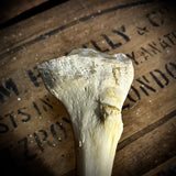 Human tibia (shinbone)