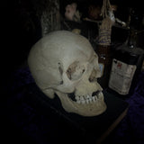 Medically prepared human skull