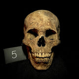 Item 5. Human skull with mandible