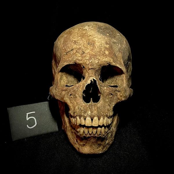 Item 5. Human skull with mandible