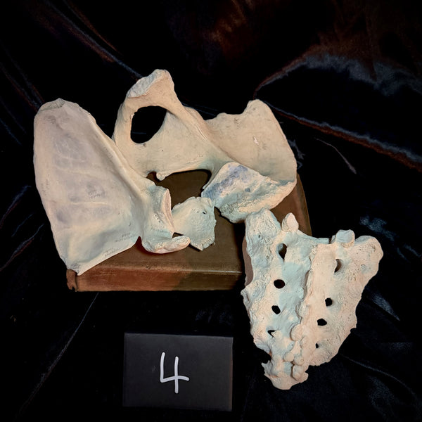 Item 4. Human bone lot