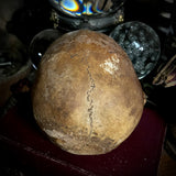 Human skull with mandible