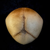 Item 1. Human fetal skull