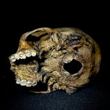 Item 13. Partial human skull