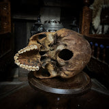 Human skull