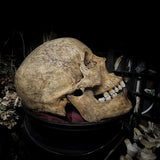 Human skull