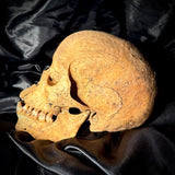Item 15. Human skull with mandible