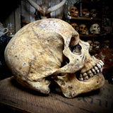 Human skull with mandible
