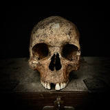 Human Skull