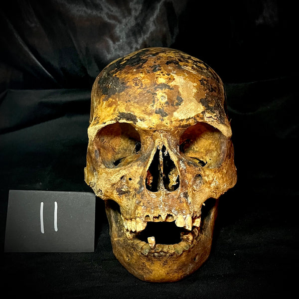 Item 11. Human skull with mandible