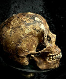 A human skull with mandible