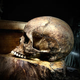 Human skull