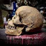 Human skull with mandible