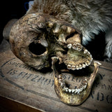 Human skull with mandible
