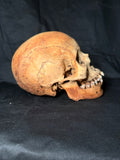 Item 15. Human skull with mandible