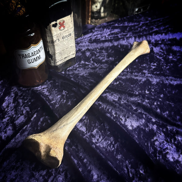 Human tibia (shinbone)
