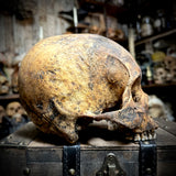 Human skull