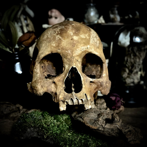 A human skull