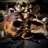 Human skull