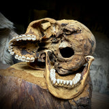 Human skull with mandible