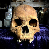 Human skull