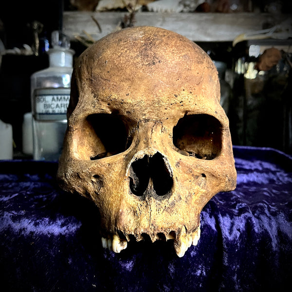Human skull