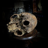 Human skull
