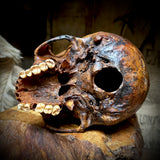 Human skull