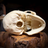 Medically prepared human skull