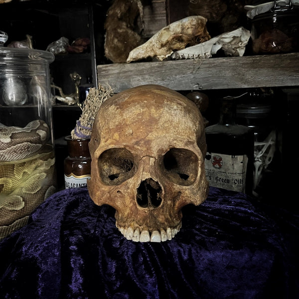 Human skull