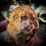 Human skull