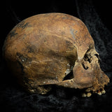 Human skull