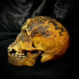 Item 11. Human skull with mandible