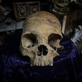Human skull