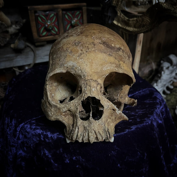 Human skull