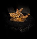 A mandible