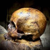 Human skull