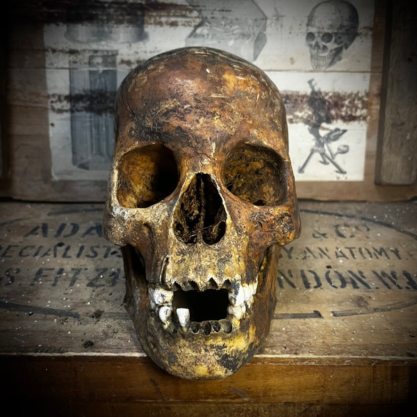 Human skull with mandible