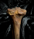 Human tibia (shinbone)