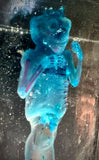 Item 1. Diaphonized human fetus