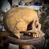 Human skull