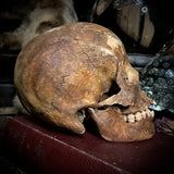 Human skull with mandible