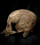 A human skull