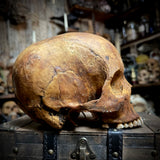 Human skull