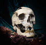 Medically prepared human skull