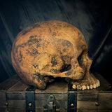Item 8. Human skull