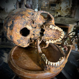 Human skull with mandible
