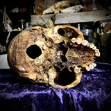 Human skull