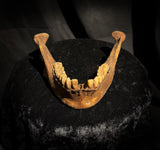A mandible
