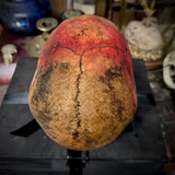 Human skull with mandible